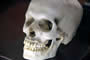 Bild 4/6: Menschenkopf skelettiert 
